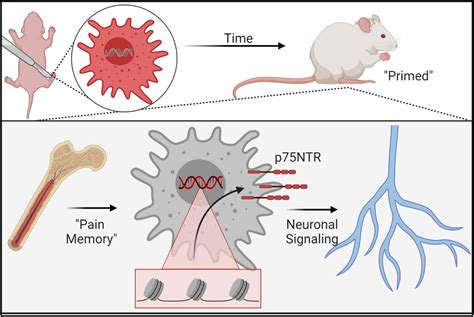 Macrophage Epigenetic Memories Of Early Life Injury Drive Neonatal