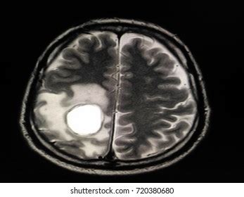 Axial Cut Magnetic Resonance Image Mri Stock Photo 1565500459