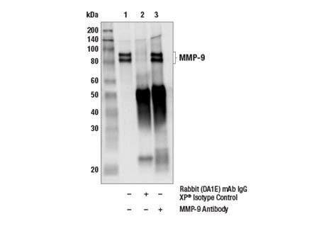 MMP 9 Antibody Cell Signaling Technology