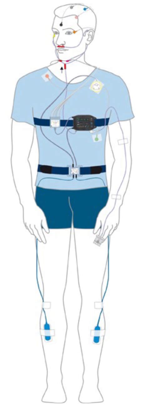 Polysomnography Psg And Multiple Sleep Latency Mslt Sleep Studies