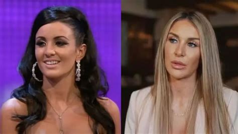 Mafs Peggy Rose Before And After Plastic Surgery