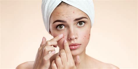 5 Tips For Managing PCOS Induced Hormonal Acne – Codex Labs Corp