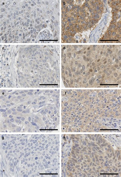 Fgfr Fgfr Fgfr And Fgfr Expression In Formalinfixed