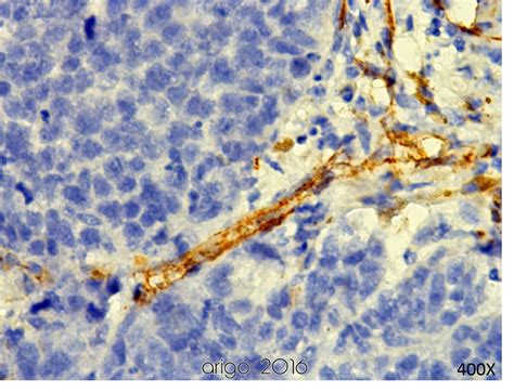 Endothelial Cell Marker Antibody Duo (CD31, CD34) (ARG30300) - arigo Biolaboratories