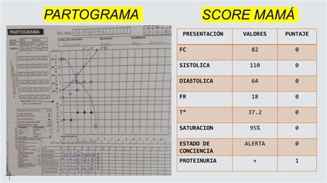 Presentaci N Caso Cl Nico Hemorragia Postparto Pptx Descarga Gratuita