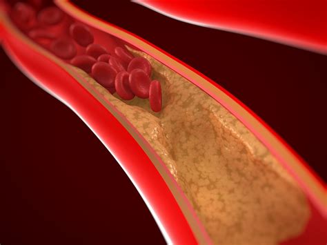 El papel de las arterias en el sistema circulatorio Medicina Básica