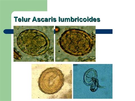 Gambar Telur Cacing Ascaris Lumbricoides Analisis