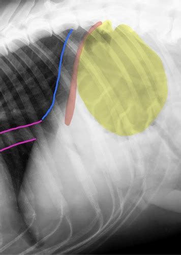 Thoracic Radiography Flashcards Quizlet