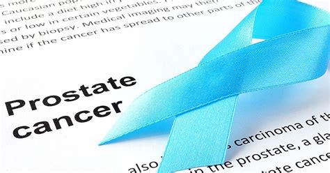 Spendergast Informed Prostate Cancer Patient Prostate Cancer News