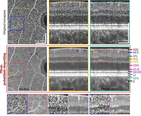 Probabilistic OCT Post-Processing Methods - OCT Research