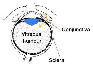 Ocular Drug Delivery Flashcards Quizlet