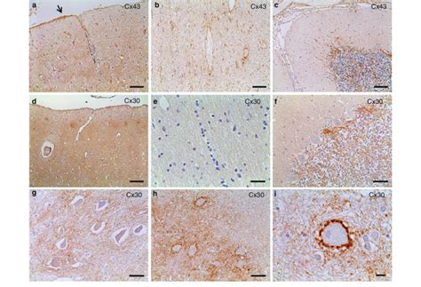 Cx43 And Cx30 Expression In Normal Control Brains A I A Case Of