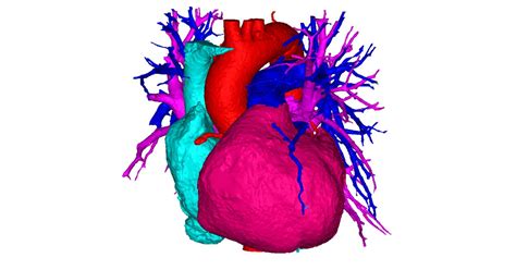 Mimics Ai Enabled Ct Heart Tool For Heart Chamber Segmentation