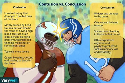 Concussion Brain Compared To Normal