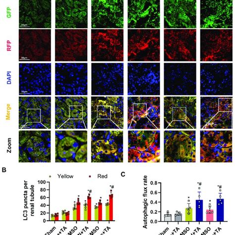 HDAC6 Inhibition Promoted Autophagic Flux In Autophagy Reporter Mice