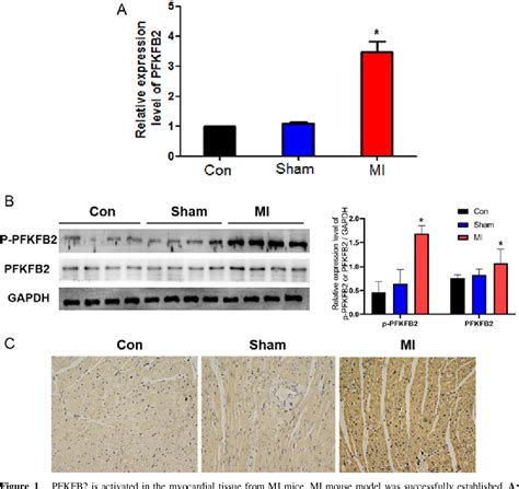 Figure 1 From HIF 1 AKT Signaling Activated PFKFB2 Alleviates Cardiac