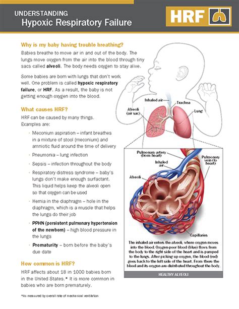 Hypoxic Respiratory Failure Hrf Nicu Parent Education Resources