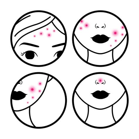 Beautiful Woman With Acne Problem Skin Royalty Free Vector