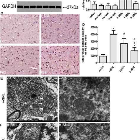 Saha Treatment Induces A Change In P Modulation In Neuropathic Pain