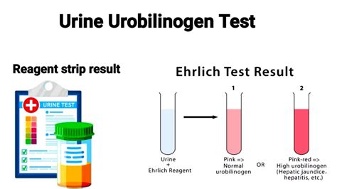 Ehrlich Aldehyde Test Test For Detection Of Urobilinogen In Urine