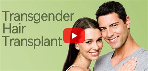 Transgender Hair Transplant Surgery In Surat Gujarat India