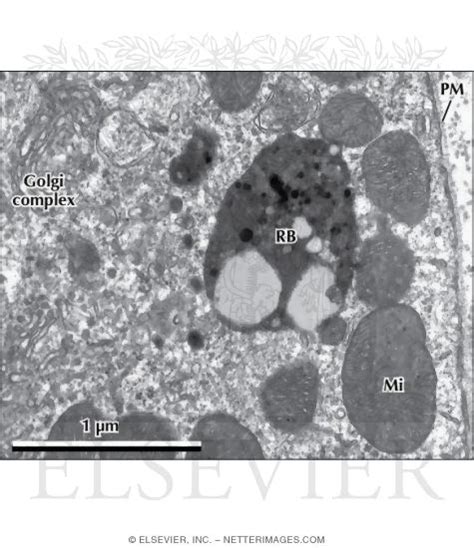 Electron Micrograph of a Tertiary Lysosome