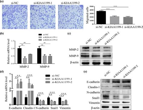 Kiaa1199 Knockdown Inhibited Hsc Migration And Suppressed Emt A Cell