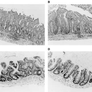 Representative Photomicrographs Of Tissue Sections From The Cecum Of An