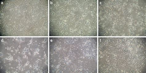 Morphology Of Escs During Conversion To Episcs Under The Phase Contrast