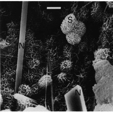 A Scanning Electron Photomicrograph Of Aragonite Fig 10 Scanning