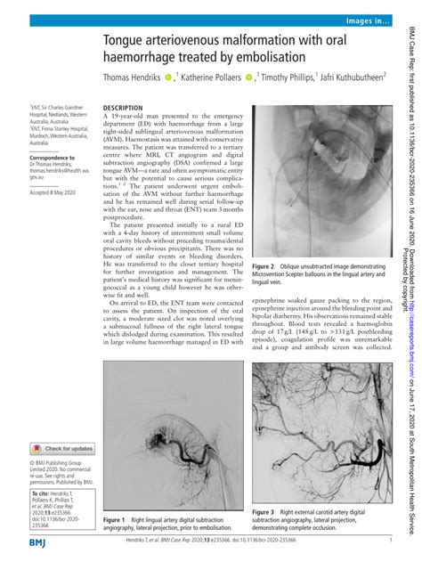 Pdf Tongue Arteriovenous Malformation With Oral Haemorrhage Treated