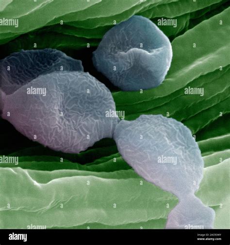 Mould Spores Coloured Scanning Electron Micrograph Sem Of Mould