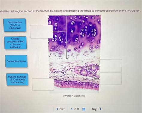 Solved Abel The Histological Section Of The Trachea By Chegg