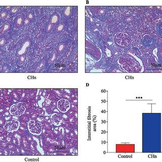 Expression Of Sirtuin Sirt And Pyroptosis Pathway Proteins In