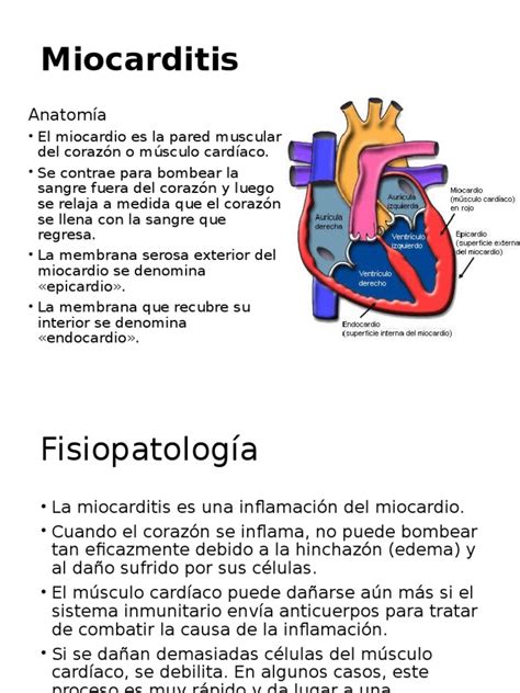 Miocarditis Músculo Cardíaco Corazón