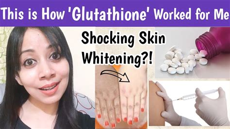 Glutathione Works For Skin Whitening For Tan Removal Pigmentations