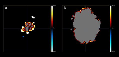 Enhanced Visualization Of Geographic Atrophy Progression Using Distance