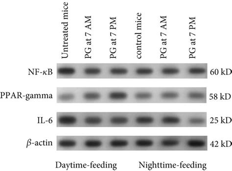 Western blot results of PPAR γ pNF κB and IL 6 expression in the