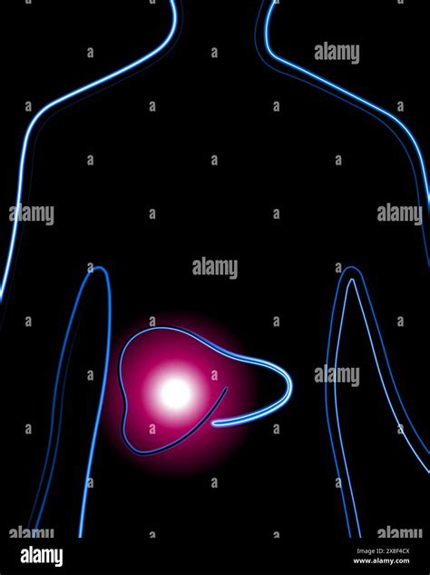 Vector Isolated Illustration Of Liver Diseases Concentration Of Pain