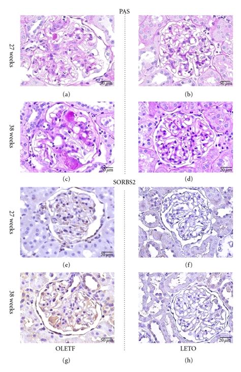 Periodic Acid Schiff PAS And Immunohistochemical Staining In The