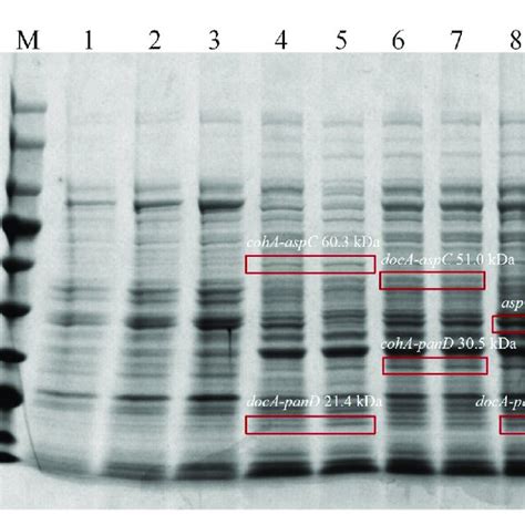 Sds Page Protein Gel Electrophoresis Of Escherichia Coli Strains Download Scientific Diagram