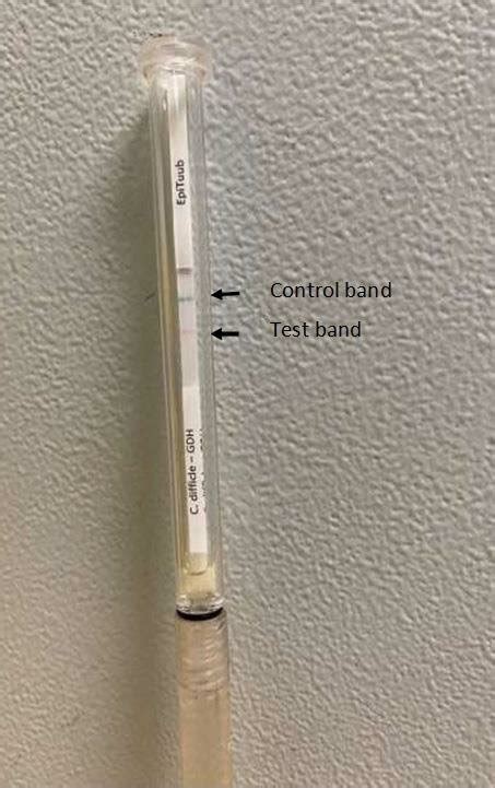 Glutamate Dehydrogenase (GDH) antigen detection test showing positive ...