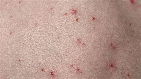 Red dots on the skin: these are the causes - World Today Journal