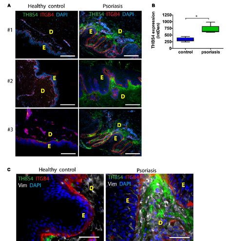 Figure 3 From Thrombospondin 4 Is A Soluble Dermal Inflammatory Signal