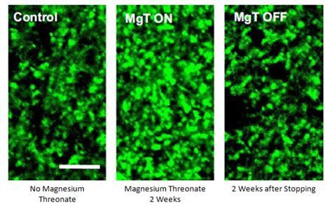 The Life Extension Blog: Brain Health Spotlight: Magnesium Threonate