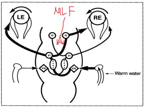 Lecture 11 Eye Movements Flashcards Quizlet