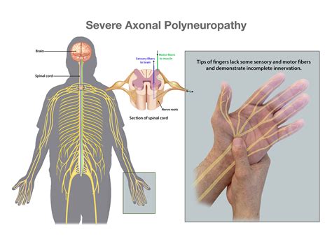 Medical Illustration And Animation Association Of Medical Illustrators