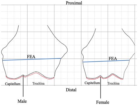 A Comprehensive Coronal And Axial Bone Dimension And Cartilage