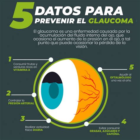 Mes Del Glaucoma Qué Es Y Cómo Afecta