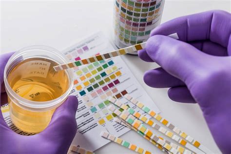 Urine Drug Test Things You Must Know To Pass A Drug Screening Test